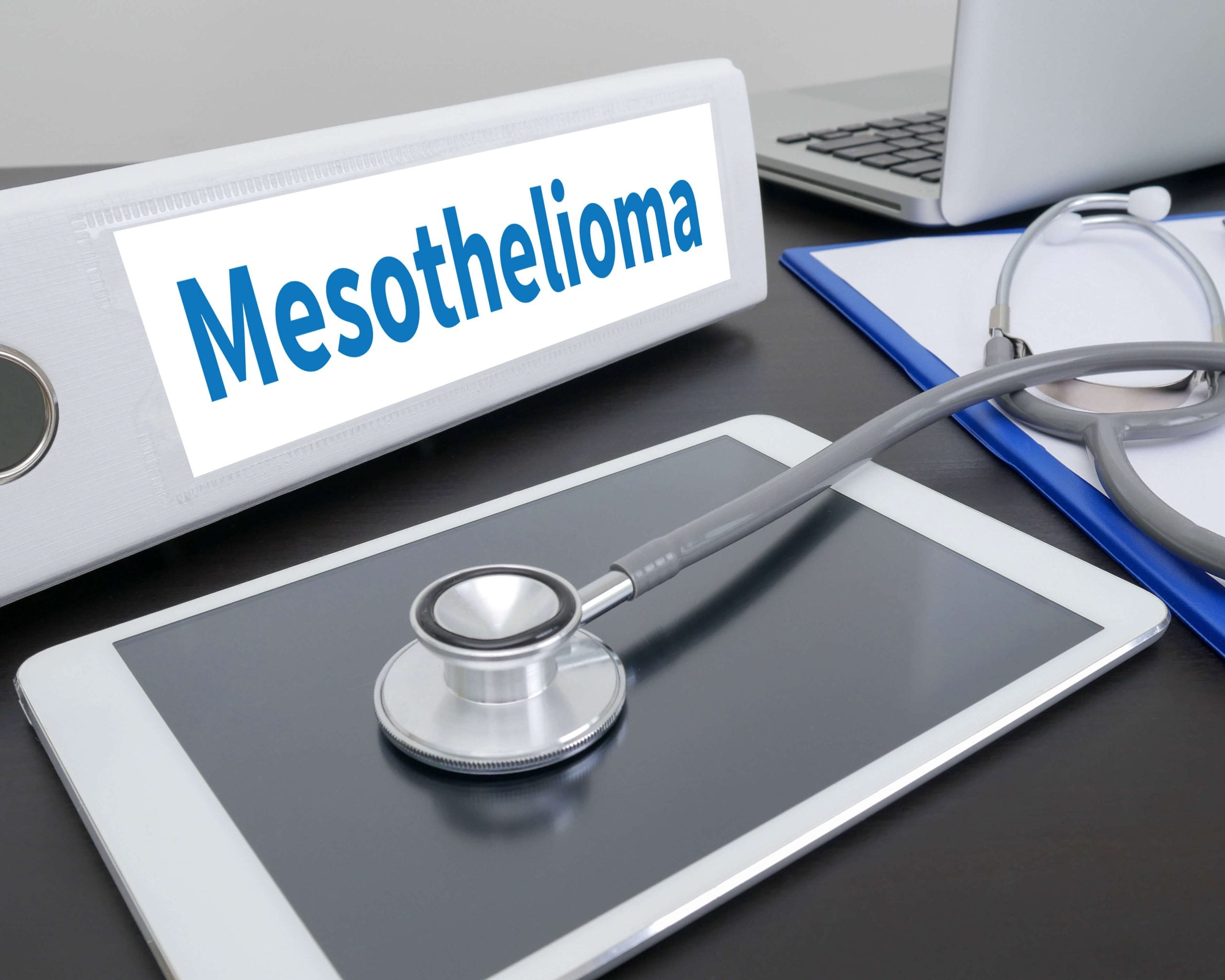 Stages-of-Mesothelioma in Santa Fe